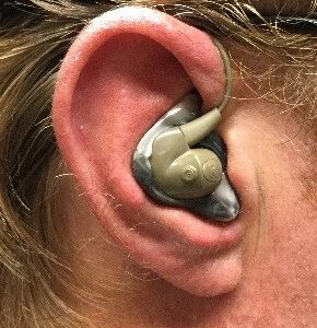 Silynx Custom Fit Ear Molds