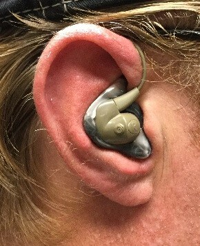 Silynx Custom Fit Ear Molds