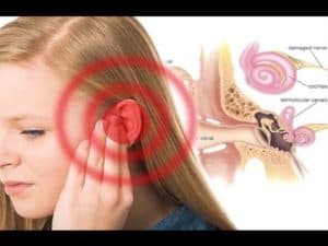 How Hearing Loss Happens Ear Diagram