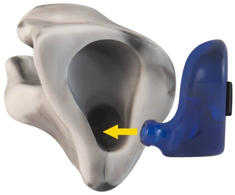 A blue E.A.R. MHS™ 360 Electronic Earplug with an arrow pointing to the gray custom sleeve.