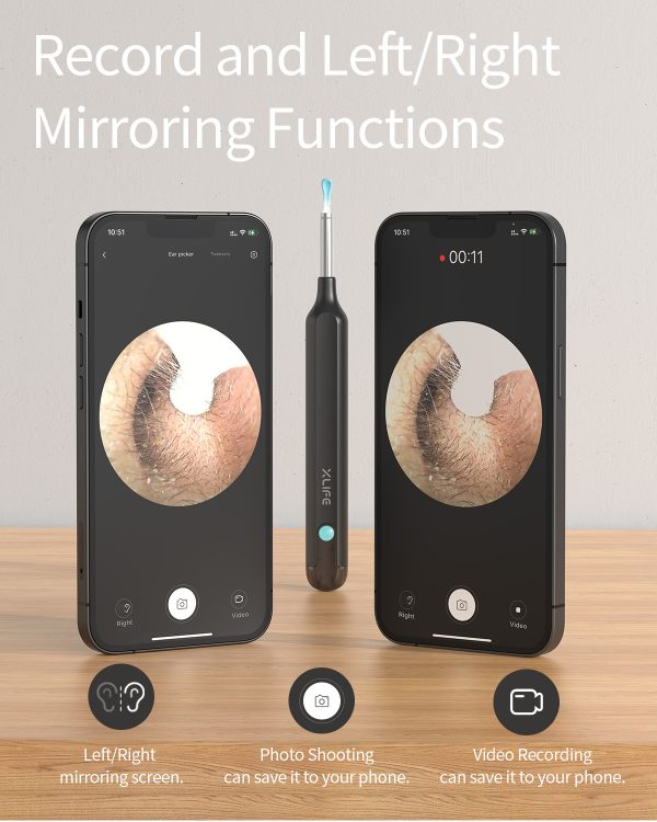 The X1 Otoscope from EAR/BeBird will record and perform left and right mirroring functions.