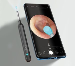 A smartphone with an EAR/BeBird X1 otoscope next to it.
