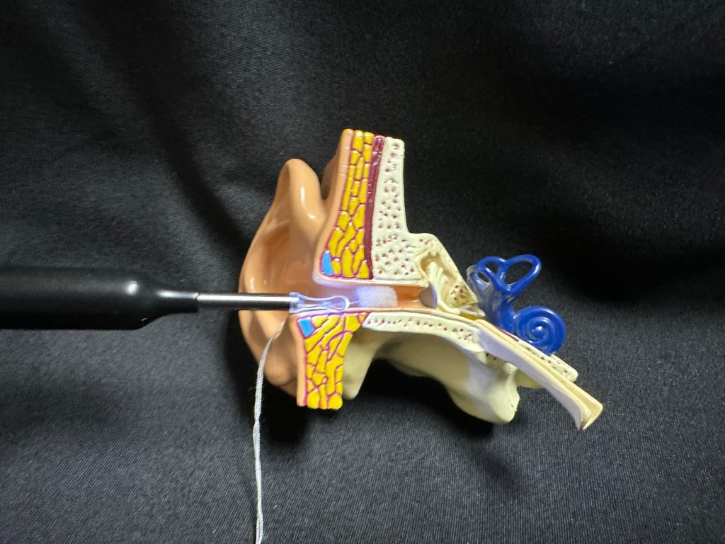 EAR/BeBird X1 Digital Otoscope used to place otoblock in ear canal before taking ear molds.