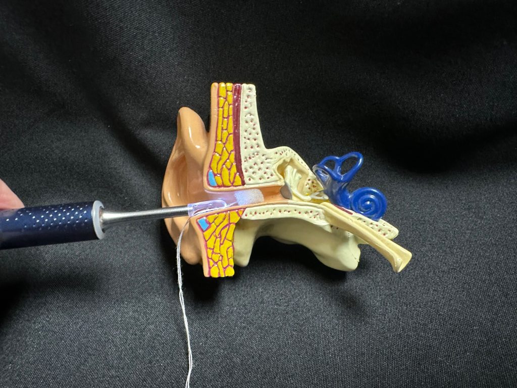 Digital otoscope M9-S from EAR/BeBird shown inserting otoblock into ear canal.