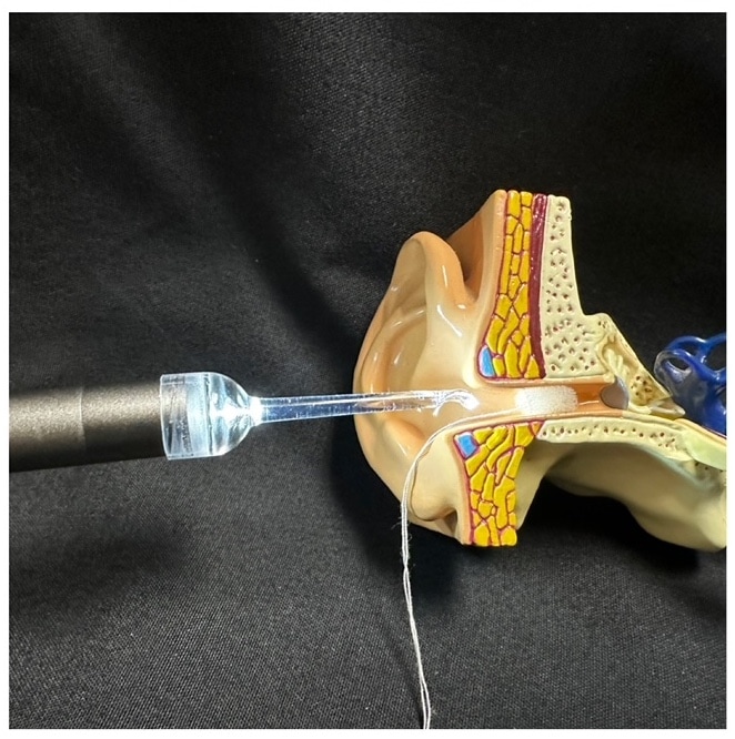 Digital otoscope with clear tip shown inside a model ear canal with otoblock.