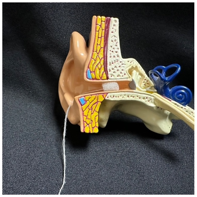 Otoblock show in a model ear canal.