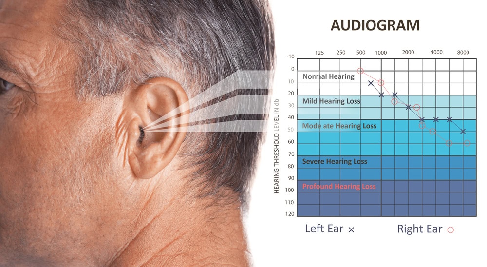 audiogram gram graph, hearing protection, earinc